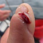 Ouch ! Won't try that again !